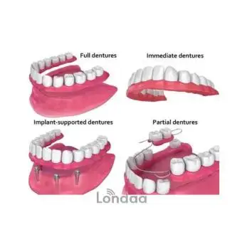 Types of Dentures for teeth replacement