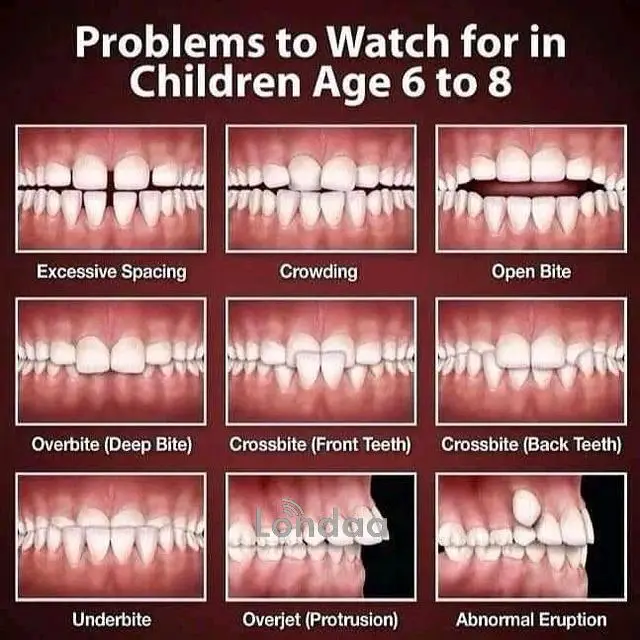 Dental health problems - 1/1