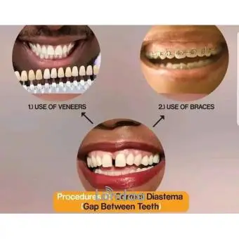 Dental treatment Uganda