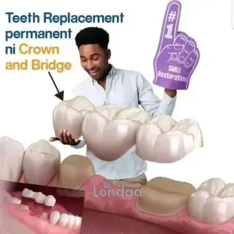 Teeth replacement kampala uganda - 1