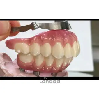 Teeth replacement with a Denture in Uganda