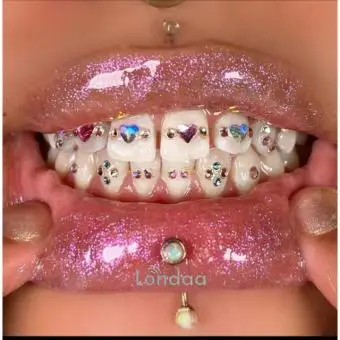 Teeth gems kampala