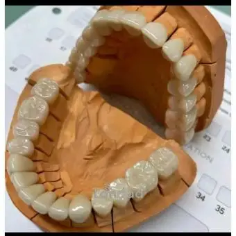Artificial teeth fabrication in kampala
