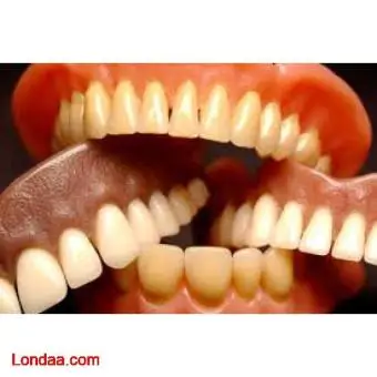 Decayed teeth restoration with artificial teeth in kampala
