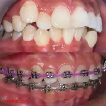 Teeth clinic in mulago