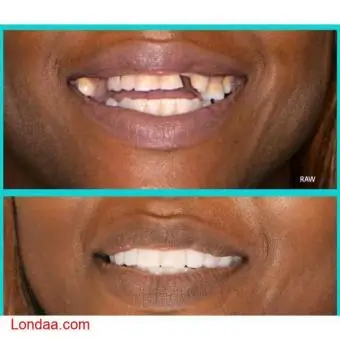 Dental health care services in kampala