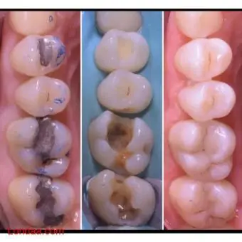 Best teeth clinic in wandegeya