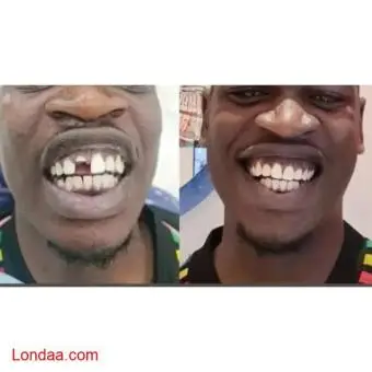 Kampala teeth clinic near me