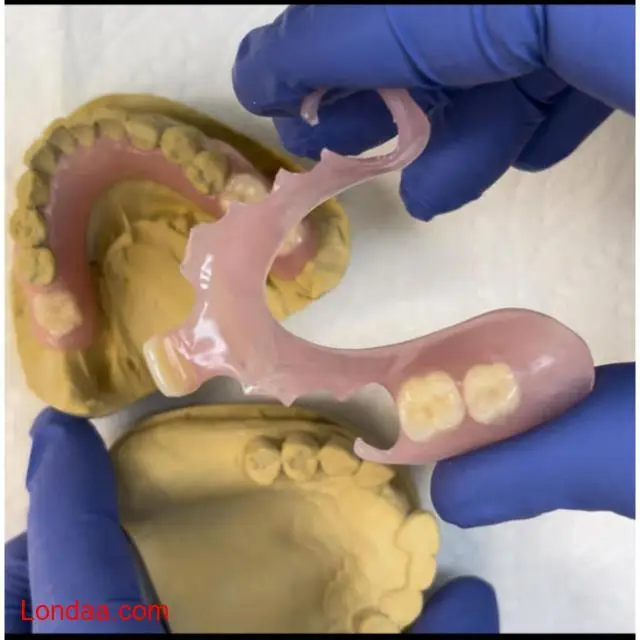 Removable denture for teeth replacement in Kampala - 1/1